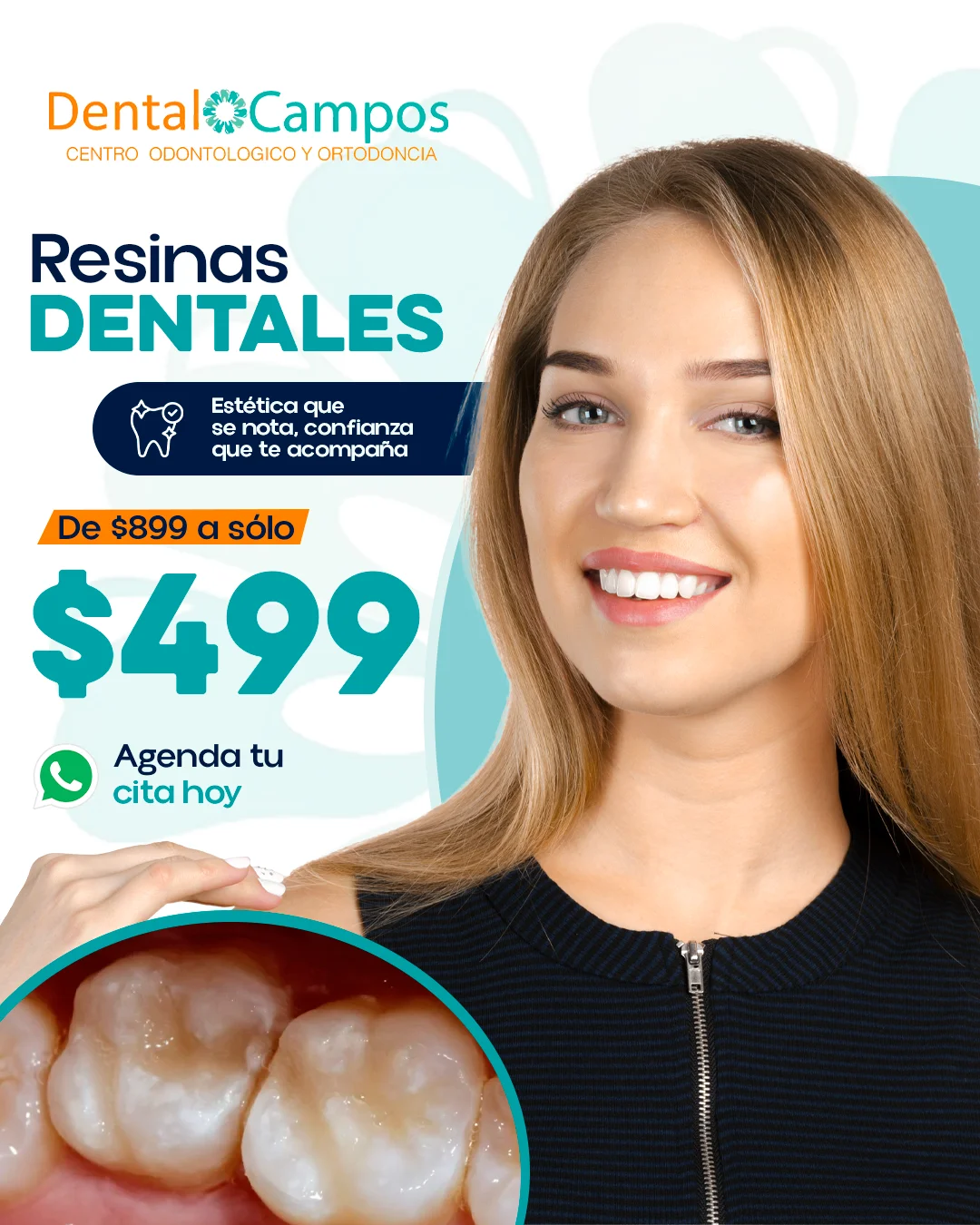 Promoción de resinas dentales de $899 a sólo $499 en Dental Campos